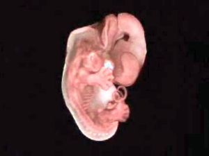 picture 3 - Like the embryo of a creature if we use the magnetic scanner